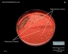 staphylococcus aureus on CAP